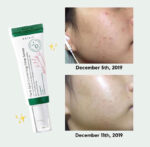 سرم ضدلک دارک اسپات اکسیس وای 50میل/|Axis y dark spot correcting glow serum - Image 2