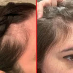 کپسول مو هیرتامین 30 عددی/Hairtamin advanced formula - Image 3