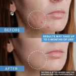 ژل ضدجوش و لایه بردار دیفرین/Differin gel 30ml - Image 2