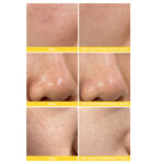 تونر آ چ آ بی اچ آ ویتامین سی روزانه کوزارکس/Cosrx aha bha vitamin c daily toner150ml - Image 4