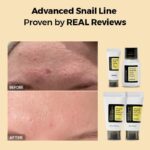 پک 4مرحله ای حلزون کوزارکس - Image 4