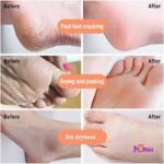 اسپری پیلینگ کف پا Rako,ضدترک و لایه بردار پوست کف پا - Image 4