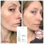 سرم آلفا آربوتین 2% + HA اوردینری ضد لک (30mL) - Image 4