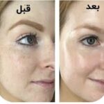 سرم آلفا آربوتین 2% + HA اوردینری ضد لک (30mL) - Image 3