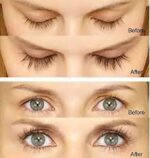 سرم تقویت کننده مژه و ابرو اوردینری مولتی پپتید لش اند برو - Image 2