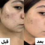 سرم آلفا آربوتین 2% + HA اوردینری ضد لک (30mL) - Image 2