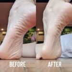 اسپری پیلینگ کف پا Rako,ضدترک و لایه بردار پوست کف پا - Image 5