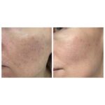 آمپول التیام بخش سنتلا ماداگاسکار اسکین 1004 - Image 4