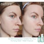 آمپول سنتلا ماداگاسکار تسکین دهنده چای تریکا - Image 3