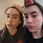 سرم نیاسینامید ۱۵ کوزارکس - Image 3