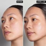 سرم آبرسان هیالورونیک اسید اینکی لیست - Image 3