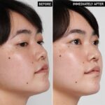 سرم آبرسان هیالورونیک اسید اینکی لیست - Image 5