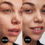 ژل شستشوی ضدجوش سالیسیلیک اسید اینکی لیست - Image 4