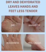 کرم دست و پا نارگیل و ویتامین E استلین ESTELIN Coconut Oil Hand & Foot Cream - Image 4