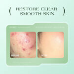 کرم تی تری-ضدجوش قوی و فوری TWG - Image 6